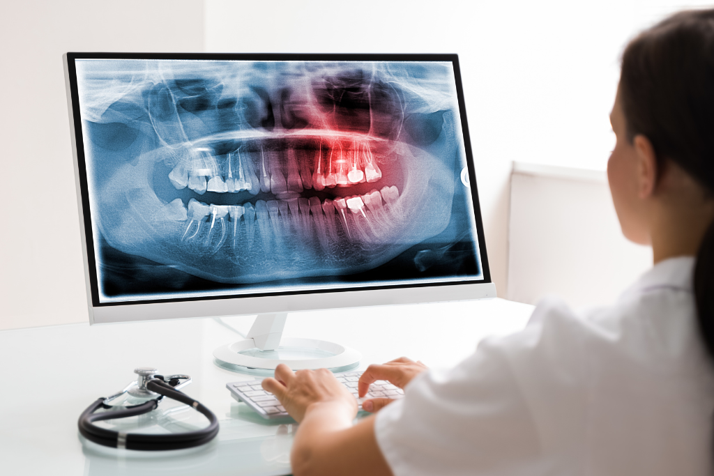 dentista utilizando un ordenador con un software de gestión clínicas dentales que muestra la imagen de la dentadura de un paciente